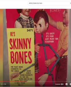 skinny bones